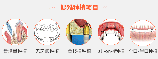 疑难种植项目、骨增量种植、无牙颌种植、骨移植种植、all-on-4种植、全口 / 半口种植