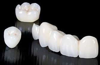 做烤瓷牙修复需要多长时间?
