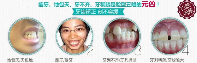 牙齿矫正的费用如何？