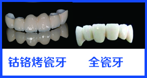 洛阳做完全瓷牙能使用多久