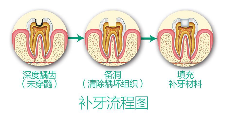 成人牙齿烂了怎么办？