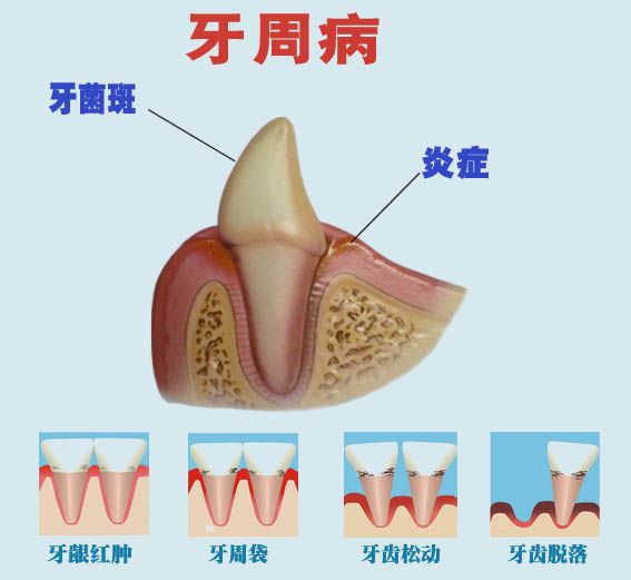 牙齿缺失后去哪里修复牙齿好？