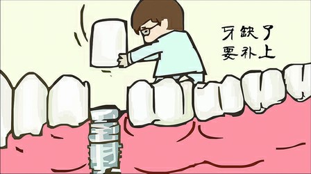 洛阳地区奥齿泰种植体价格是多少？