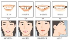 DEO数字化美学矫正技术