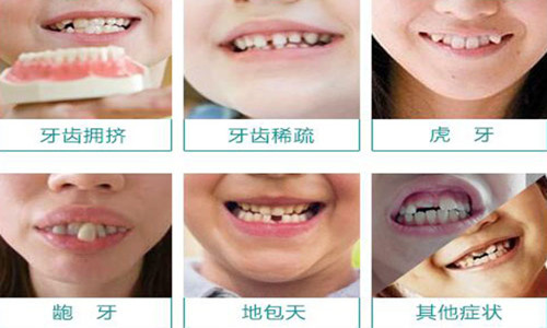 哪种材料的隐形矫正好？