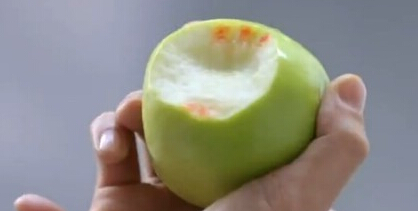 出现牙龈出血症状该怎么治疗？