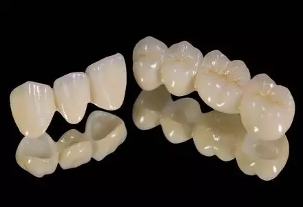 烤瓷牙的材料分为哪几种？