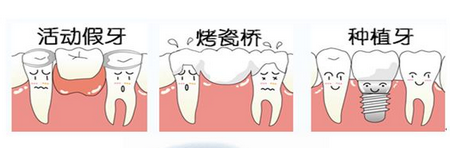 安装假牙那种好