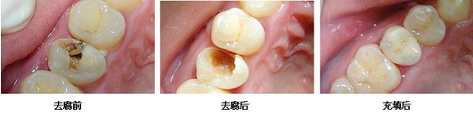 补牙医院哪家好