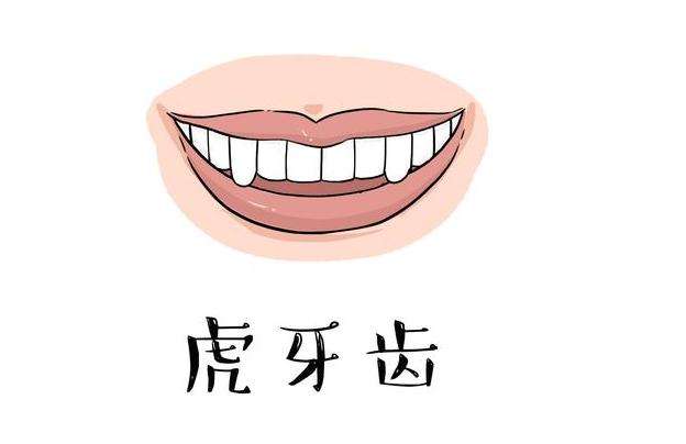 虎牙怎么矫正
