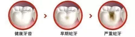 补牙的好处