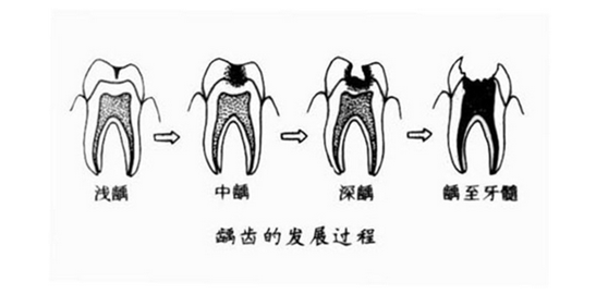 补牙的过程