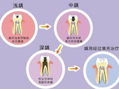 洛阳拔蛀牙多少钱
