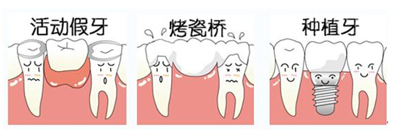镶牙能用多久