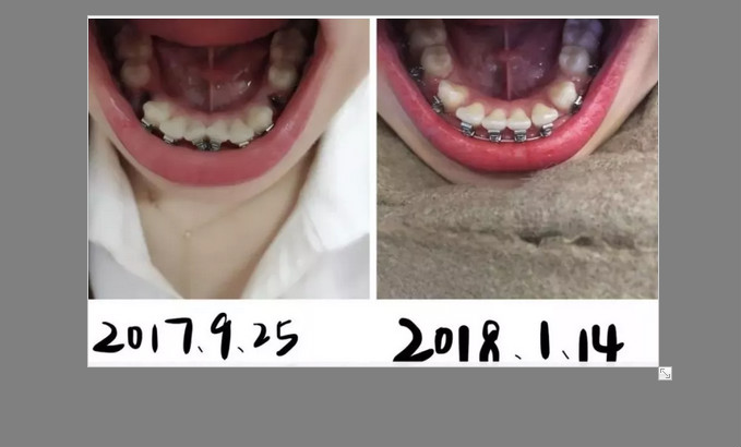 牙齿不好看怎么办？戳这里看看网民都怎么说！